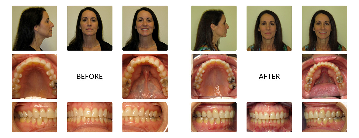 before after photos